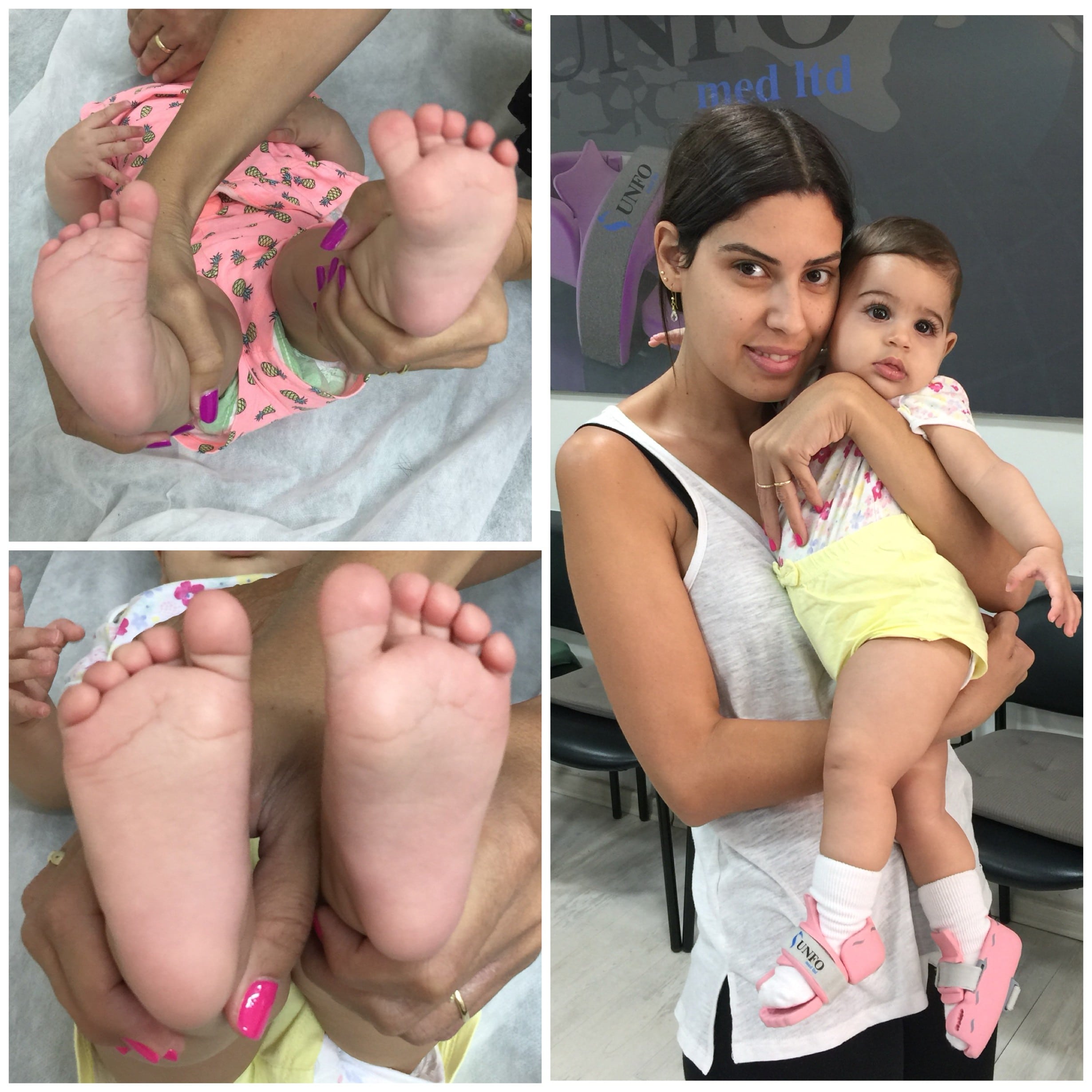 metatarsus adductus shoes for toddlers